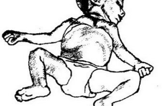 travmaticheskiy opyt i horror igry tonkaya gran mezhdu udovolstviem i stradaniem